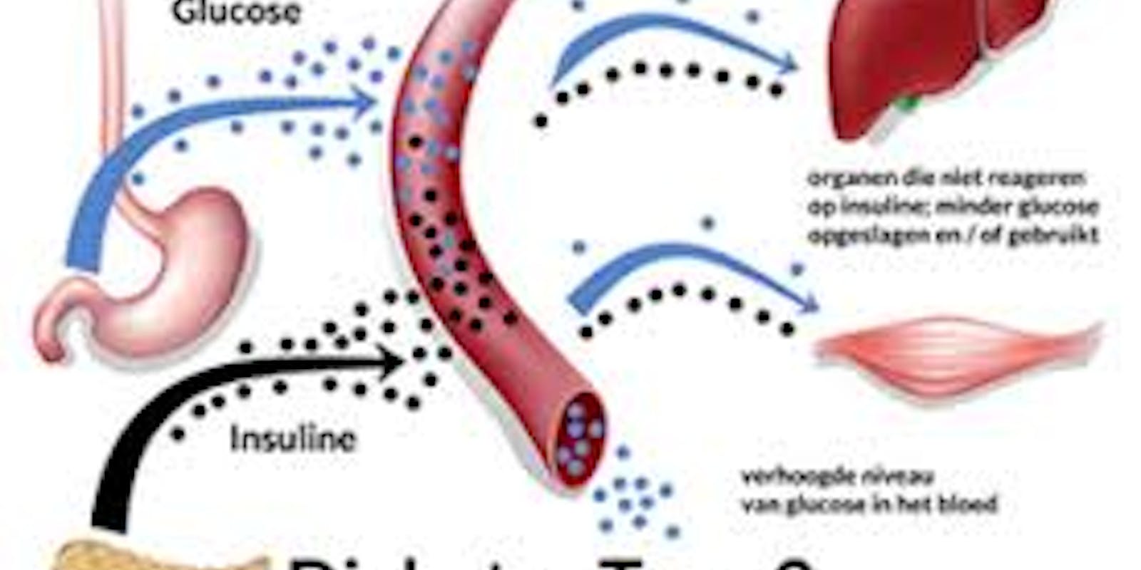 Winnaar publicatieprijs NAV: plantaardige meervoudig onverzadigde vetzuren hebben mogelijk gunstig effect op diabetes