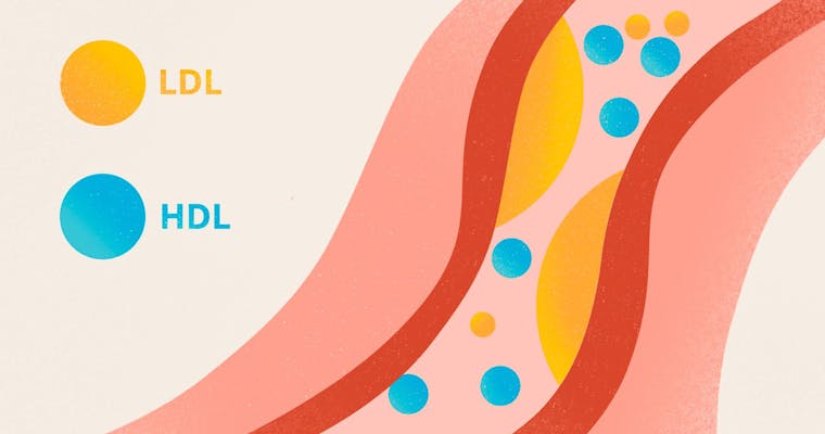 HDL-cholesterol: behulpzaam, schadelijk, of schuldig door associatie?