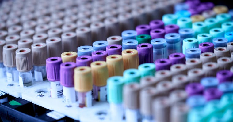 De noodzaak van een meer agressieve benadering van cholesterolverlaging